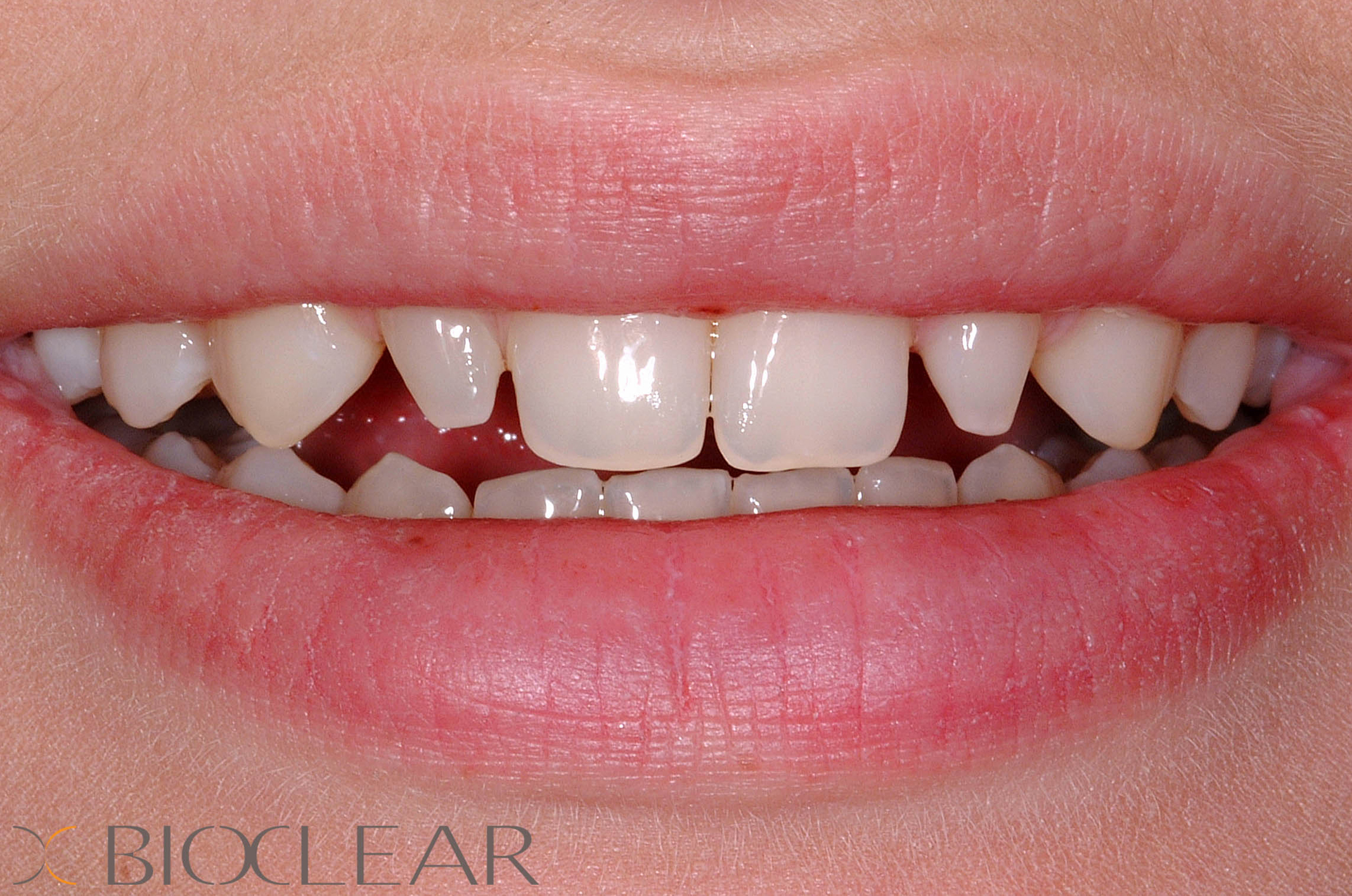 The Bioclear Method The Tanshire Clinic